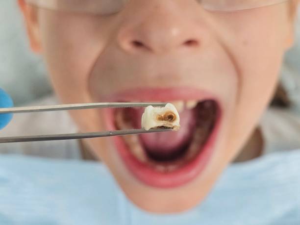 Best Emergency Dental Care for Sports Injuries in Sycamore, GA